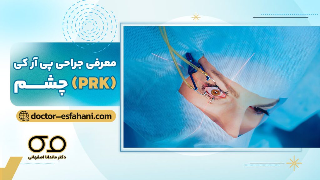 تصویر شاخص جراحی prk