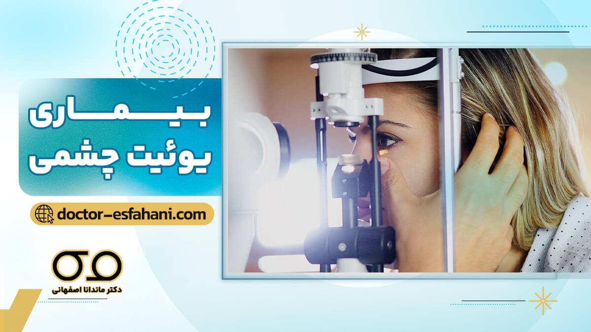 عکس یوئیت چشم