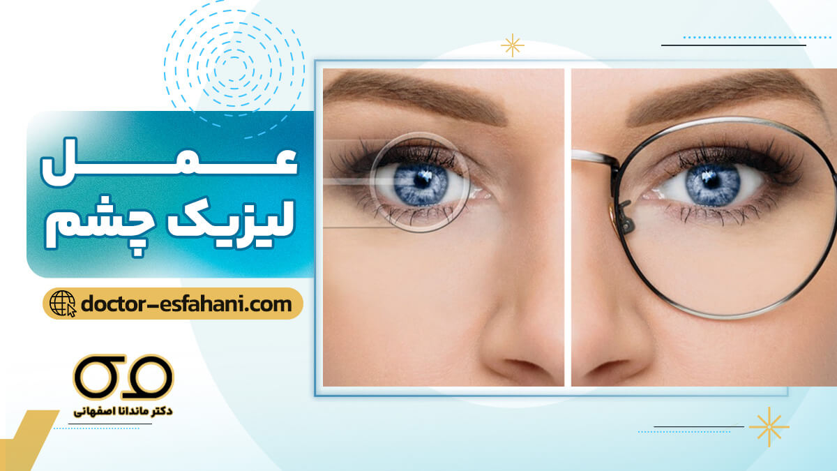 جراحی لیزیک چشم