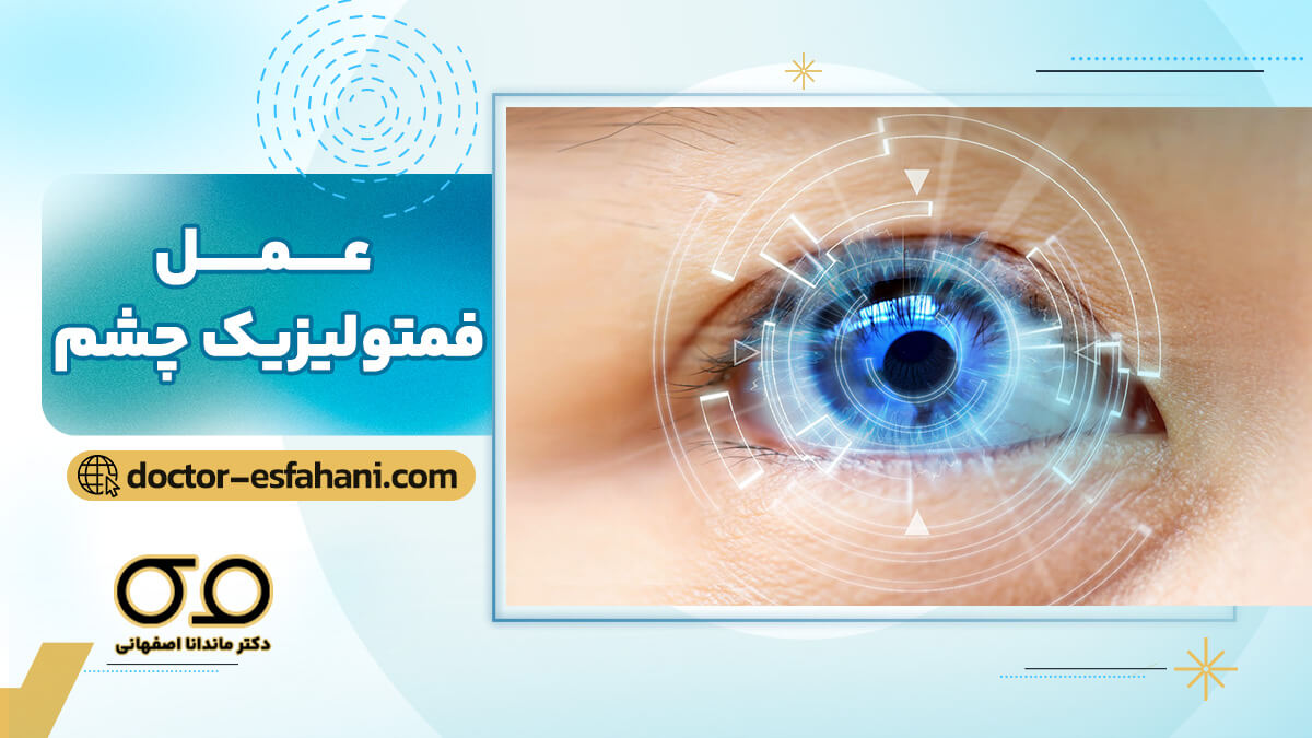 جراحی فمتولیزیک