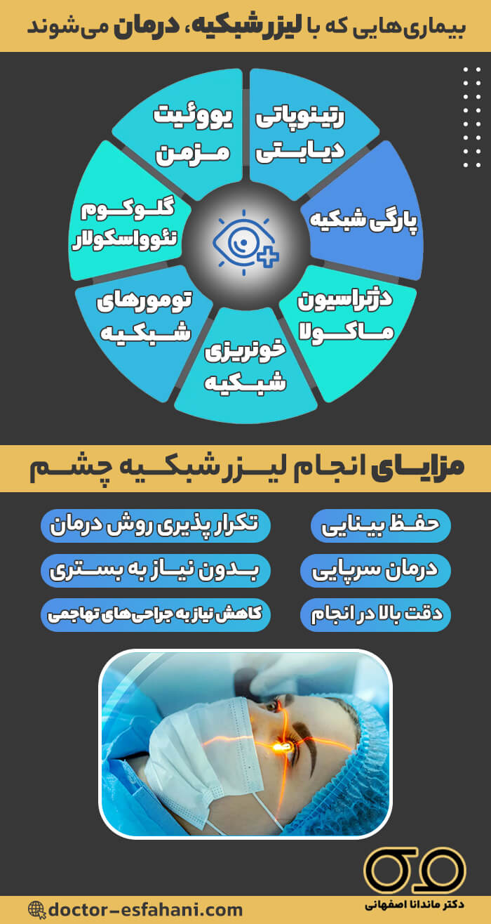 کاربرد لیزر شبکیه