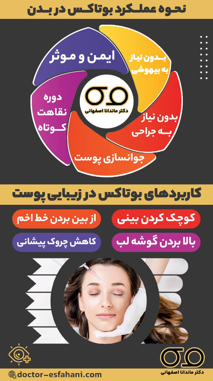 نحوه عملکرد بوتاکس