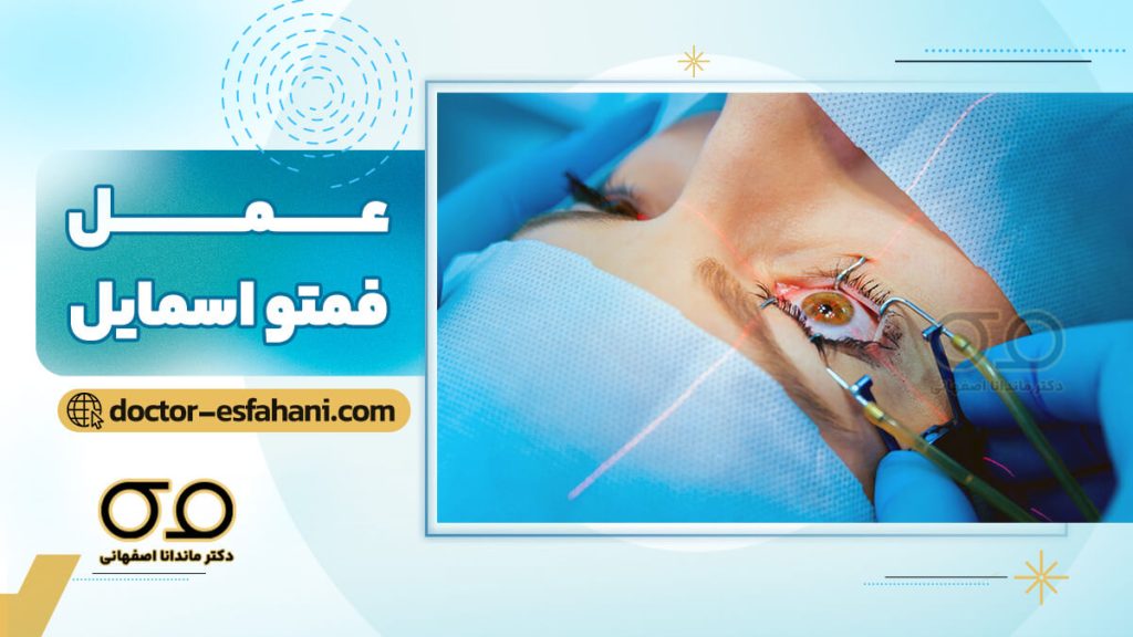 عمل فمتو اسمایل