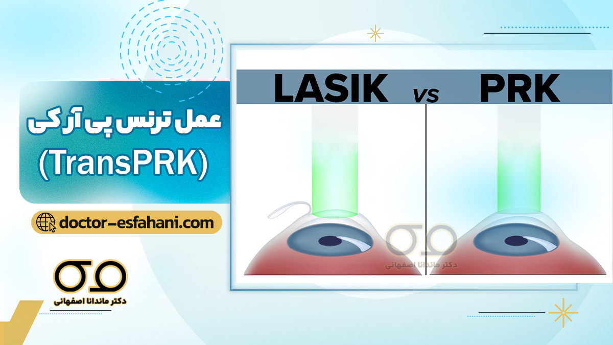 ترنس پی آر کی (Trans PRK)