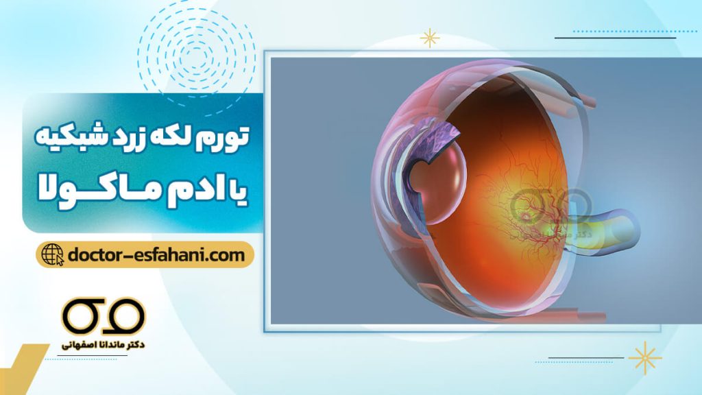 ادم ماکولا چیست؟
