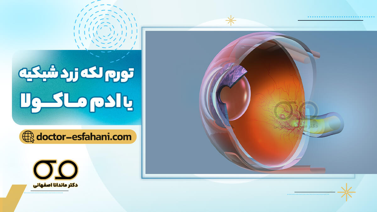 ادم ماکولا چیست؟