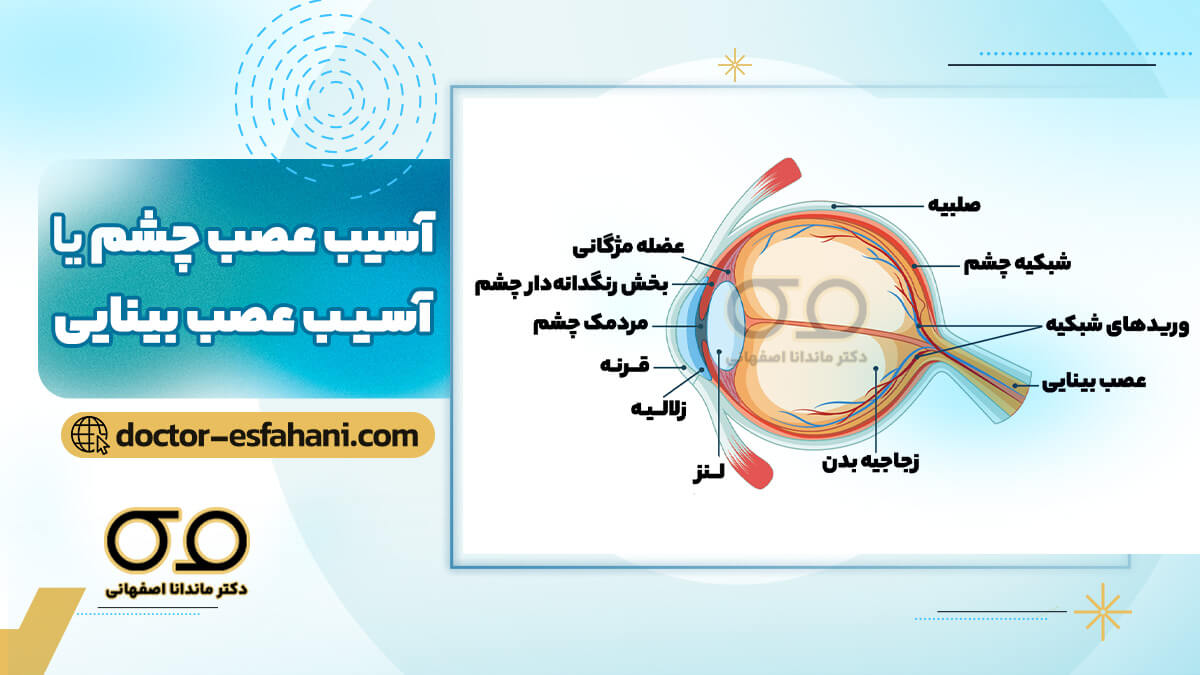 آسیب عصب بینایی