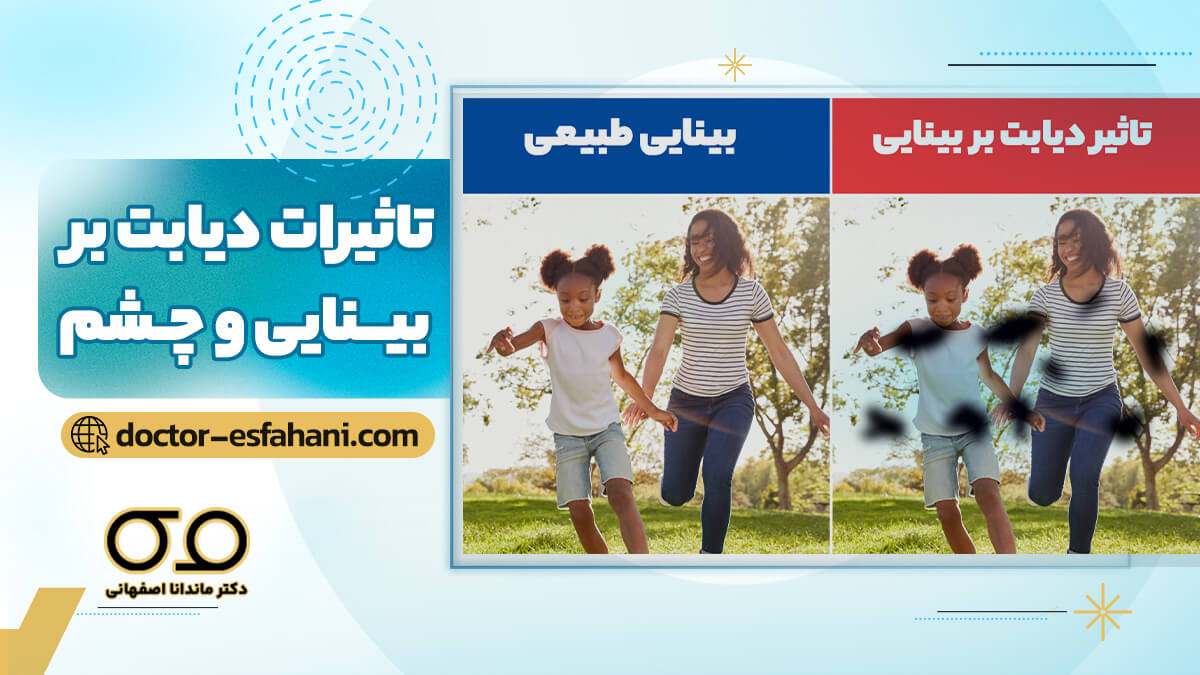 اثر دیابت بر بینایی و چشم
