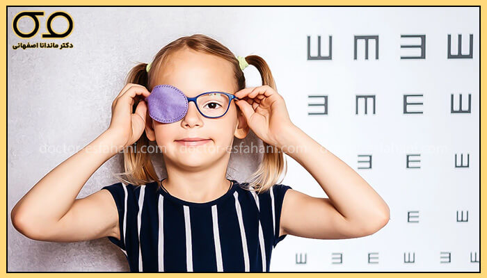 تست تنبلی چشم در خانه