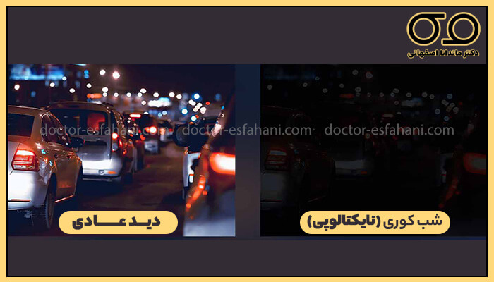 تفاوت دید عادی و شبکوری