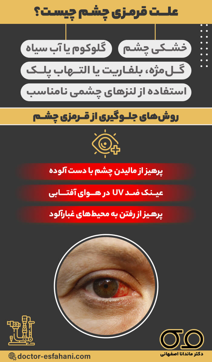 علت قرمزی چشم 
