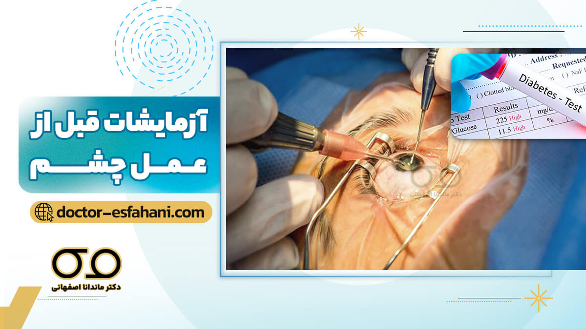 تصویر شاخص لیست تمام آزمایشات قبل از عمل چشم؛