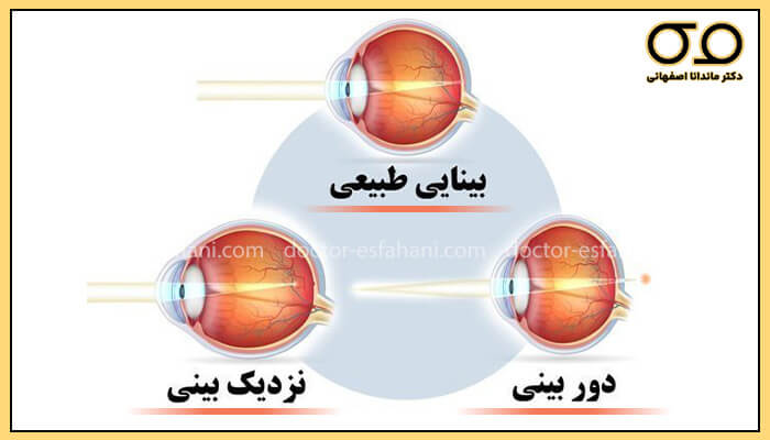 اندازه‌گیری میزان انکسار