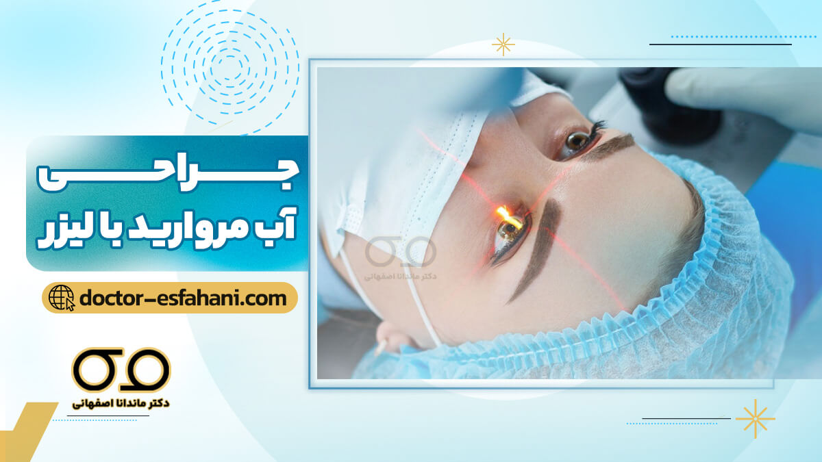 تصویر جراحی آب مروارید چشم با لیزر