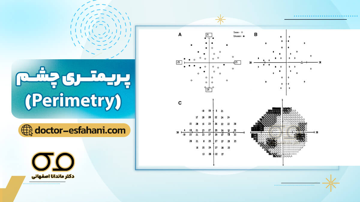 پریمتری چشم