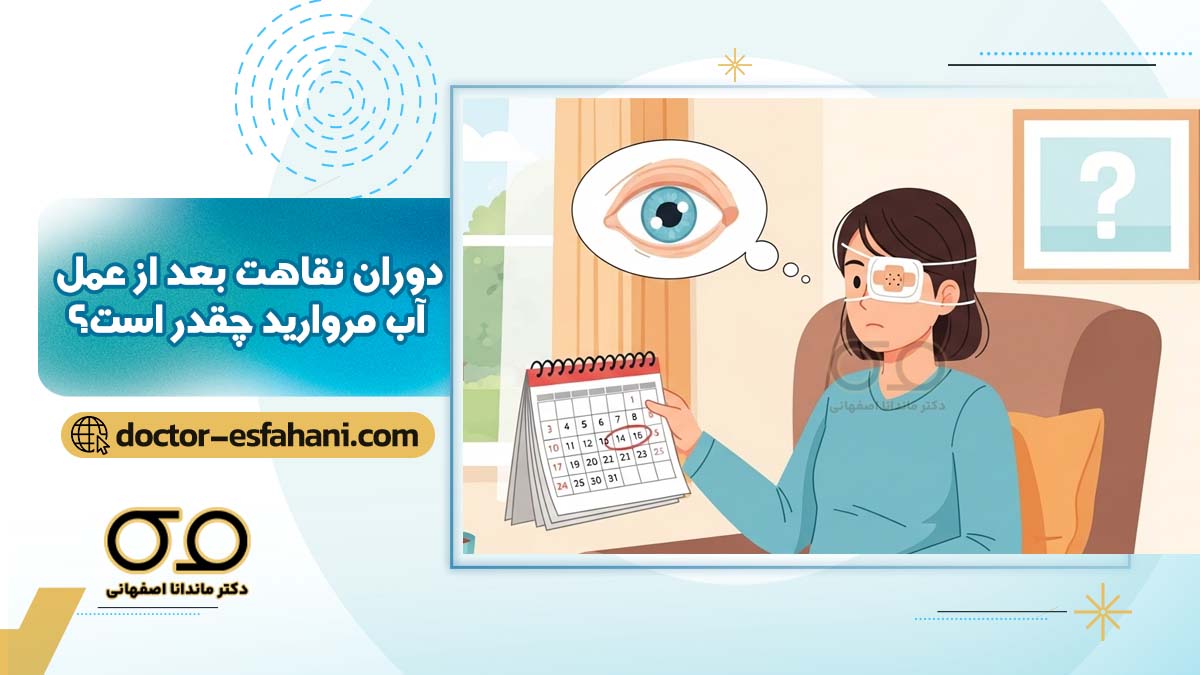 دوره نقاهت بعد از عمل آب مروارید چقدر است؟