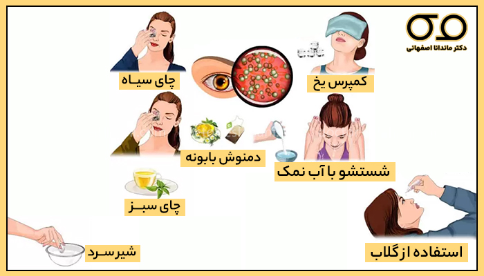 روش های ضد عفونی کردن چشم
