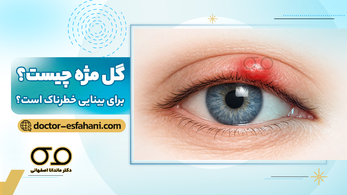 تصویر گل مژه
